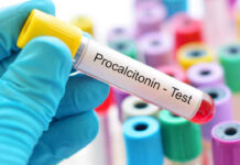 PROKALSİTONİN, YENİDOĞAN UZMANLARI OKUMASIN LÜTFEN! – Prof. Dr. Alişan YILDIRAN