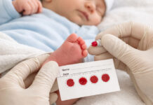 Yeni Doğan Tarama Testi ve Topuk Kanı hk – Doç. Dr. Cüneyt KONURALP